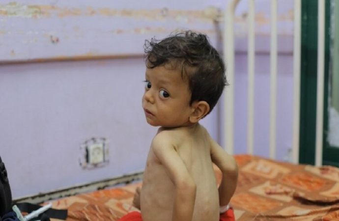 بريطانيا تعمل على إخراج أطفال مرضى ومصابين من غزة