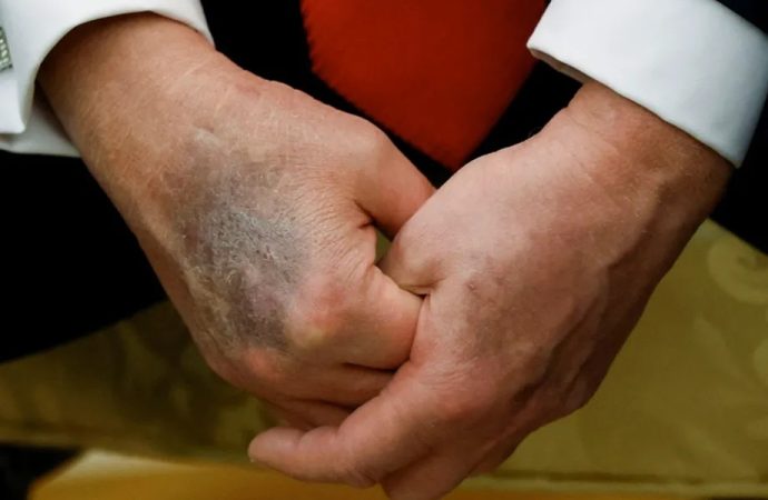 ترامب يرد على شائعات وفاته: بأفضل حال!